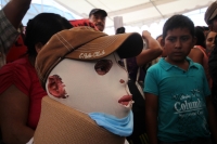 Miércoles 17 de junio del 2015. Tuxtla Gutiérrez, AgustÃn Gómez Pérez, joven inmolado durante las protestas del mes de diciembre pasado durante su conferencia de prensa momentos antes de regresar a la comunidad Chigton en el municipio de Ixtapa. Miércoles 17 de junio del 2015. Tuxtla Gutiérrez, AgustÃn Gómez Pérez, joven inmolado durante las protestas del mes de diciembre pasado durante su conferencia de prensa momentos antes de regresar a la comunidad Chigton en el municipio de Ixtapa.