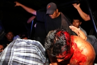 Sábado 29 de junio del 2013. Tuxtla Gutiérrez, Chiapas. Policía se enfrenta con el bloque magisterial.